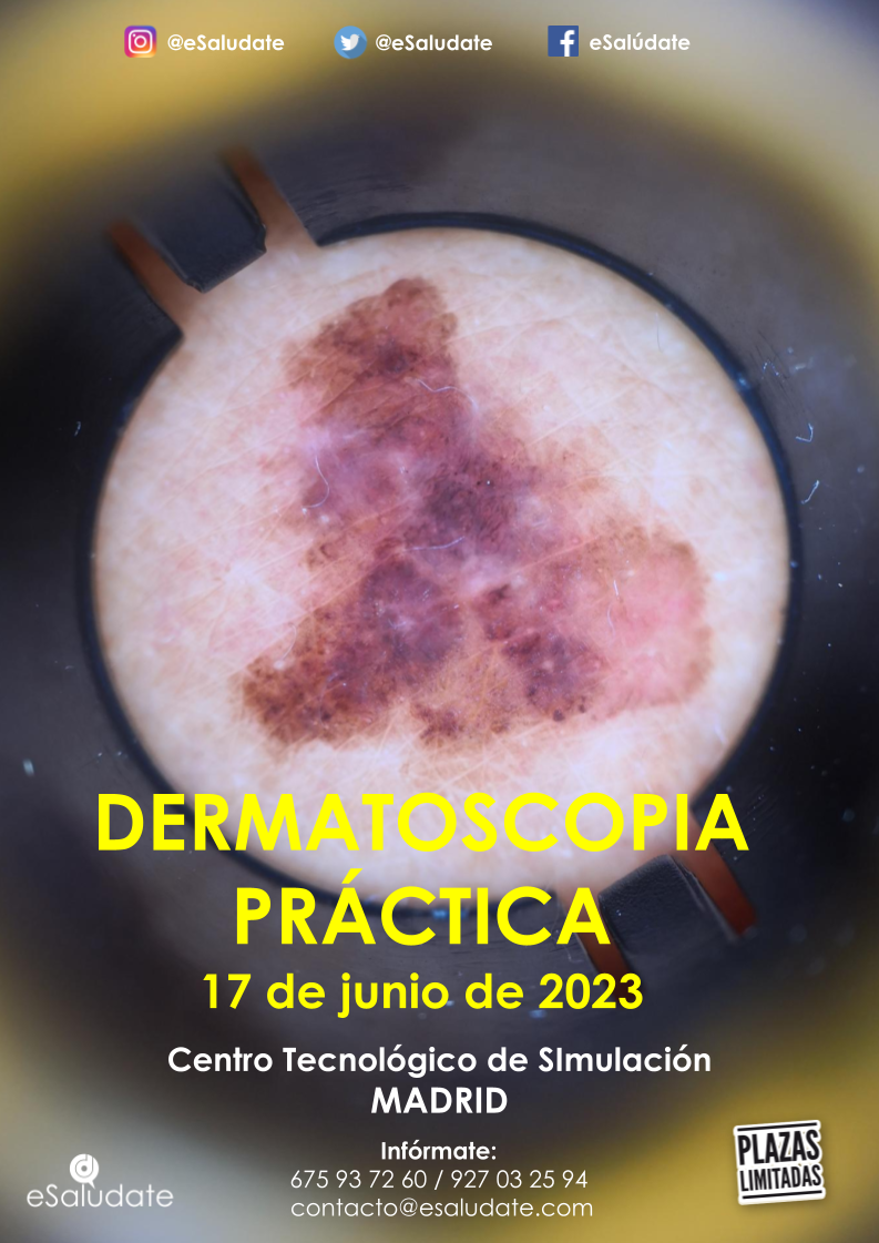 2022   DERMATOSCOPIA PRCTICA Pptx(6)