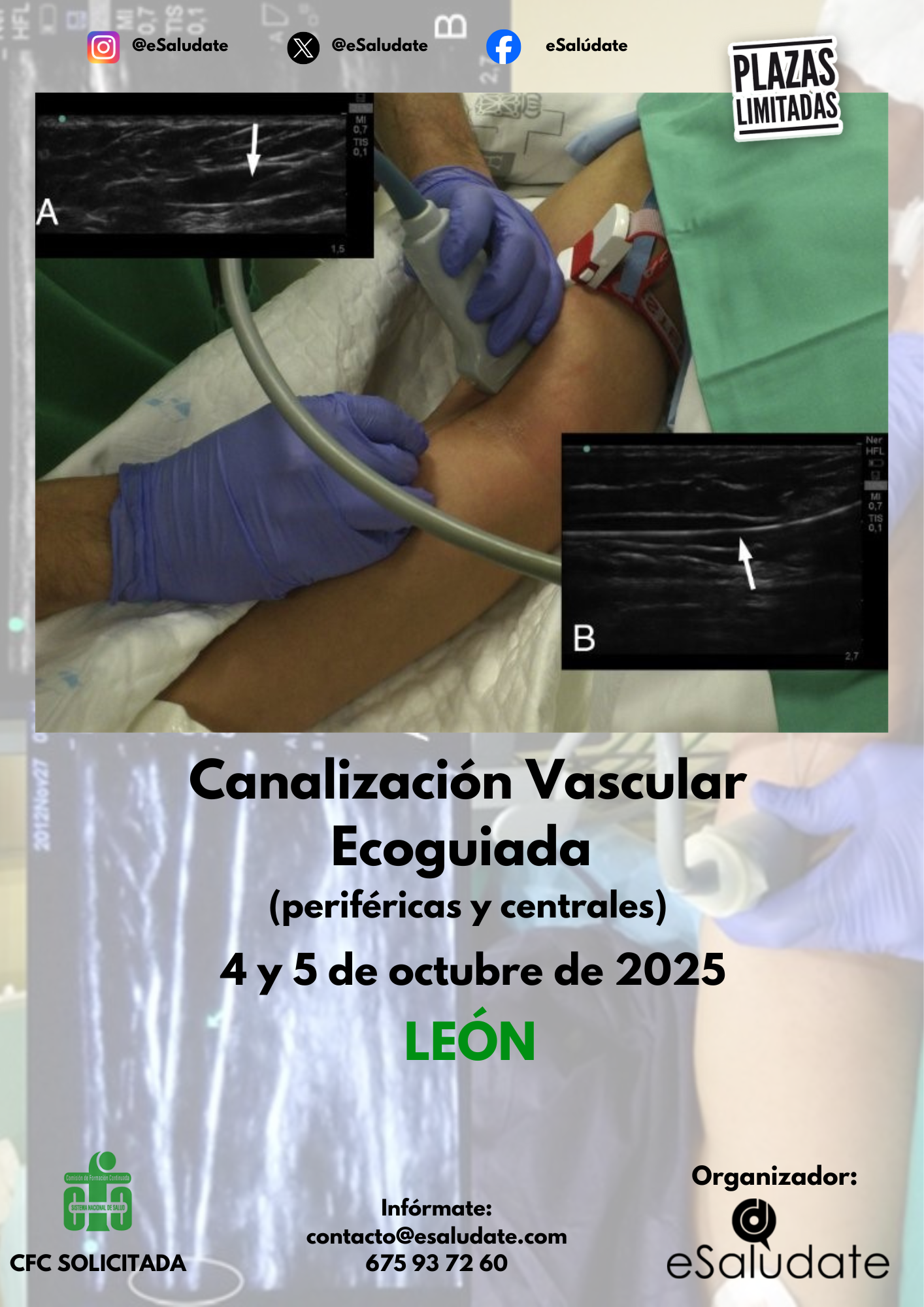 2025   Canalizacin Len