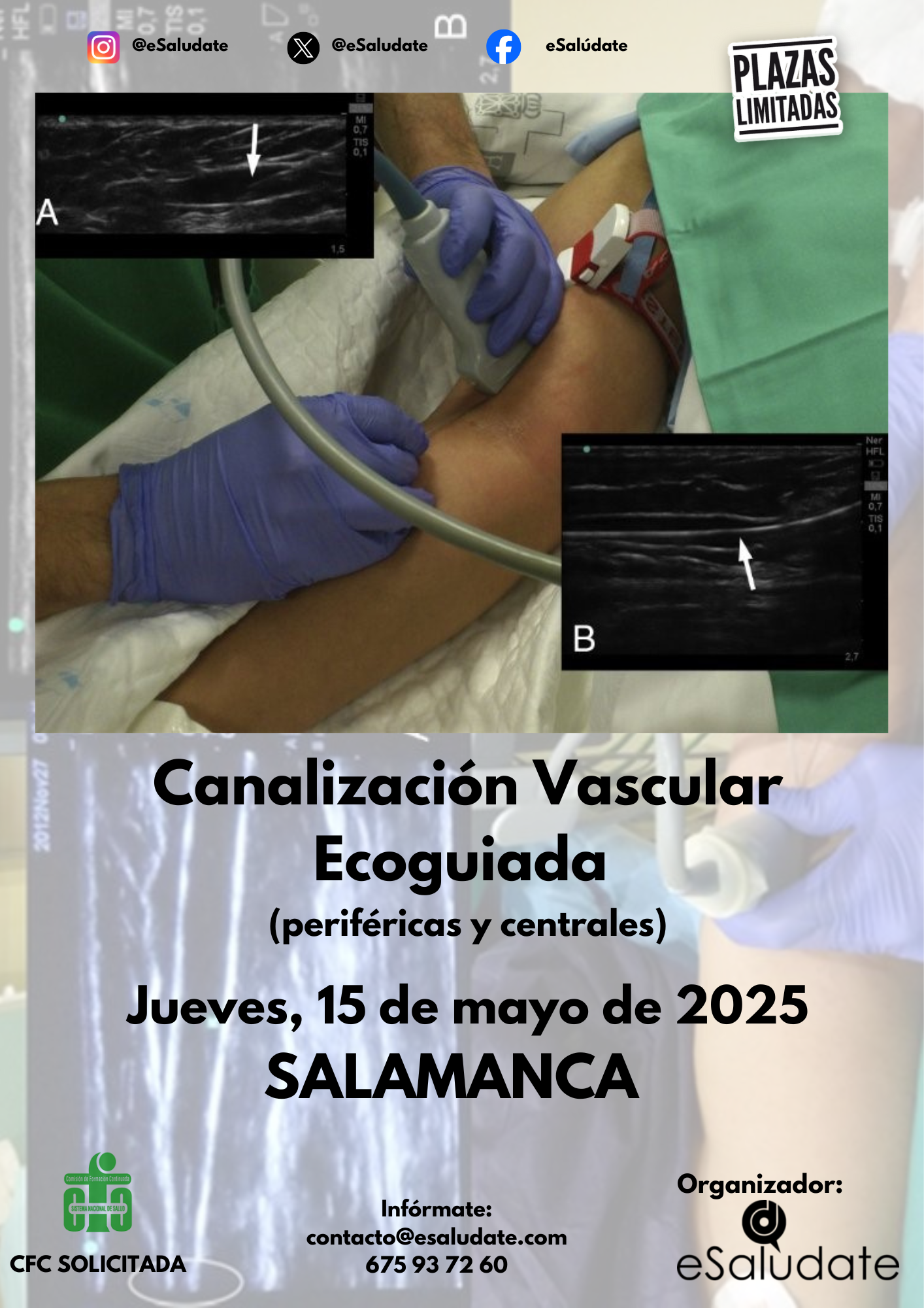 2025   Canalizacin Vascular Salamanca