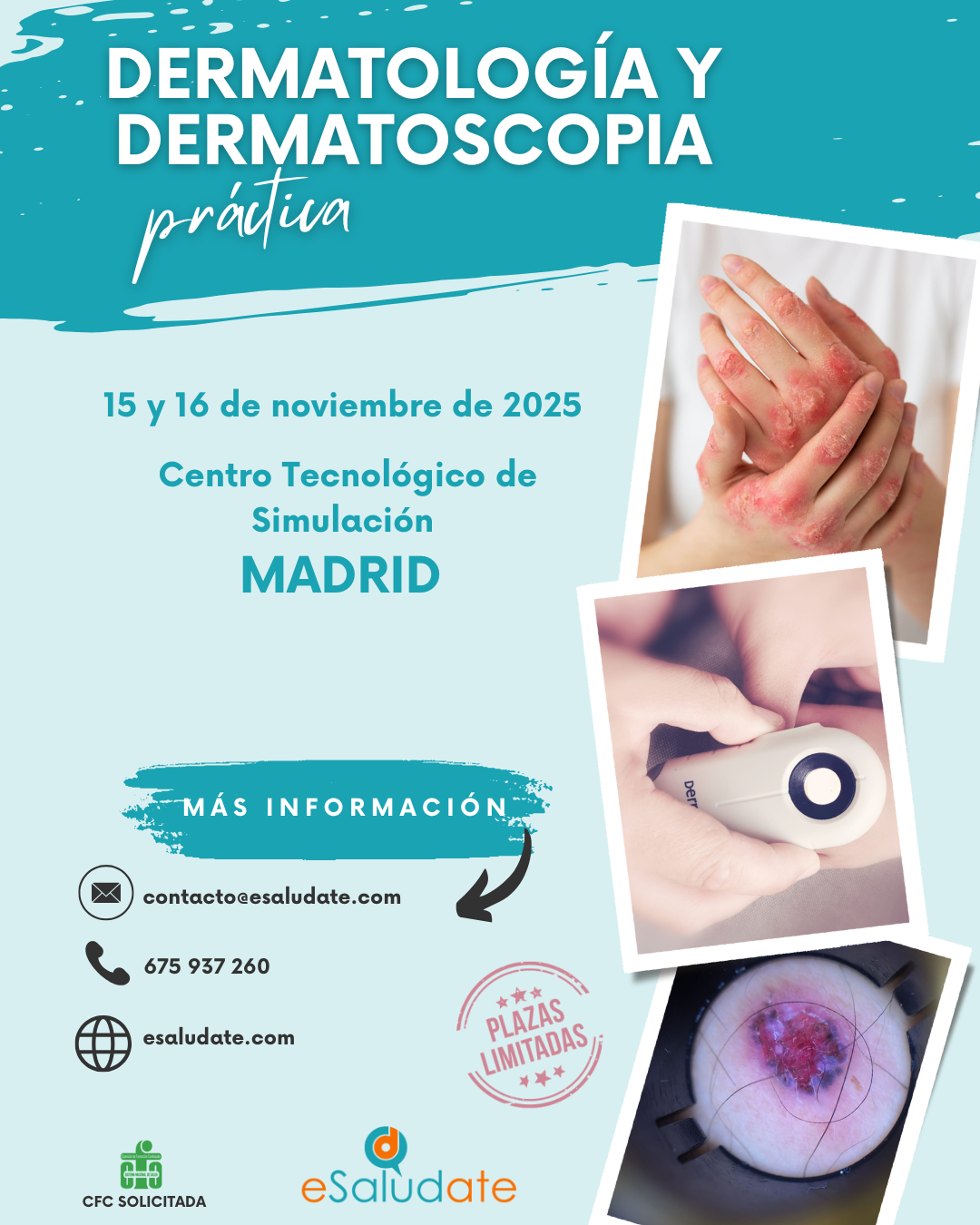 2025   Dermatologa Y Dermatoscopia