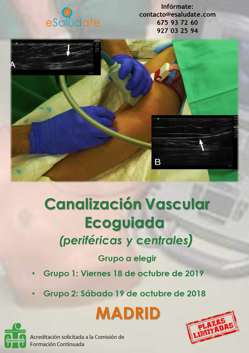 CARTEL Canalizacin Octubre 2019