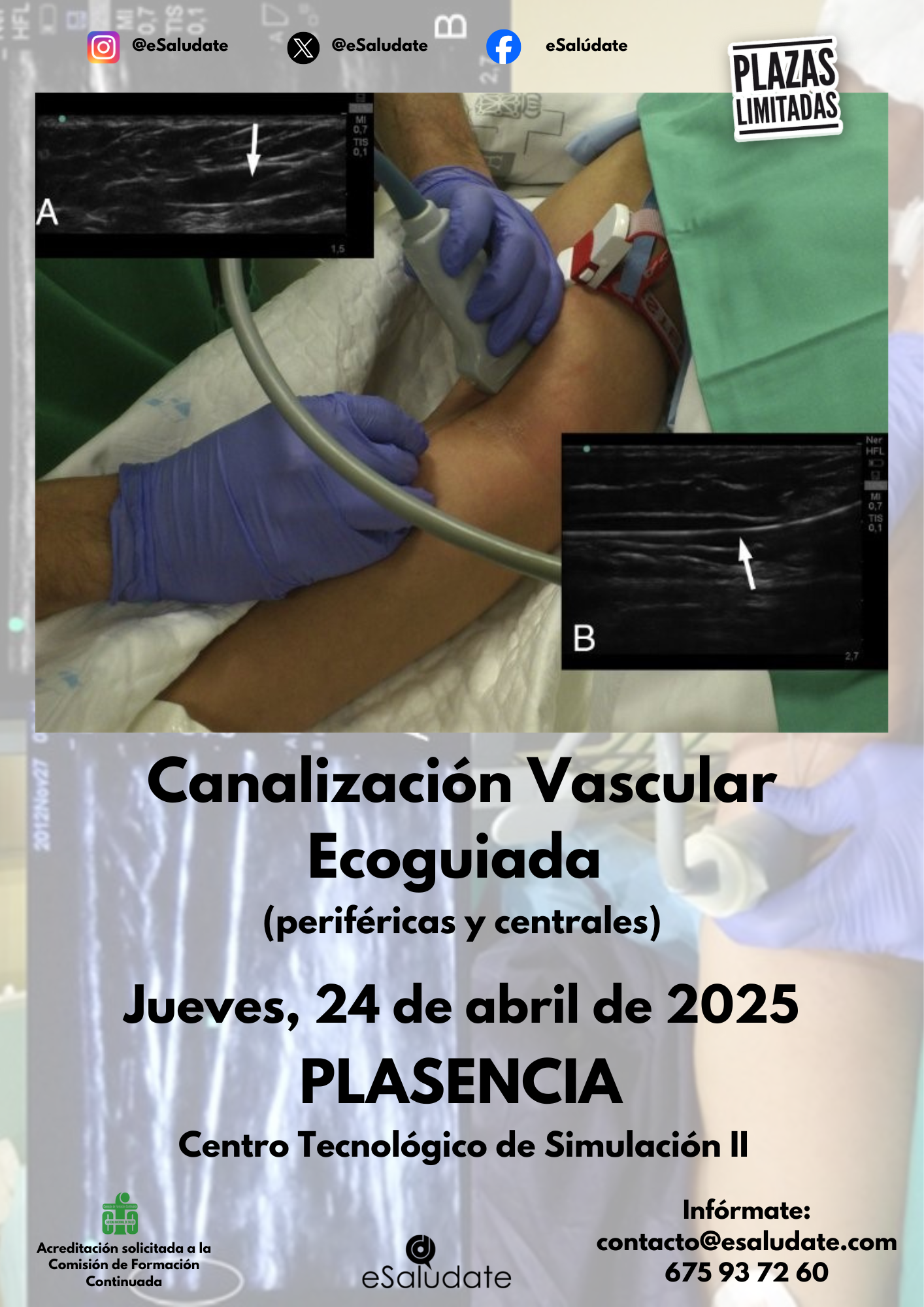 Canalizacin Vascular (2)