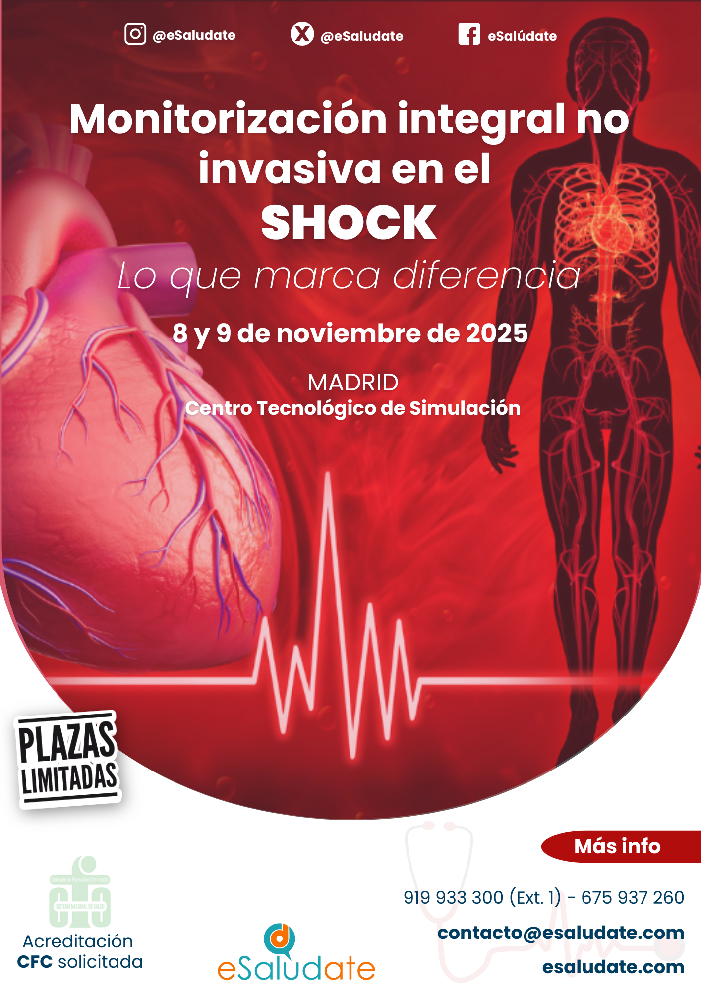 Cartel Manejo Del Shock(1)