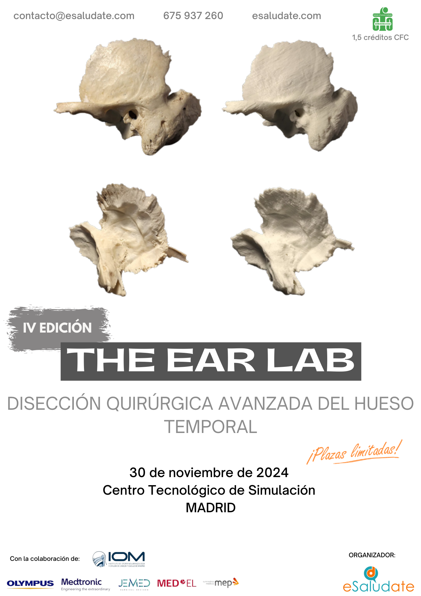 The Ear Lab   30 De Noviembre (1)
