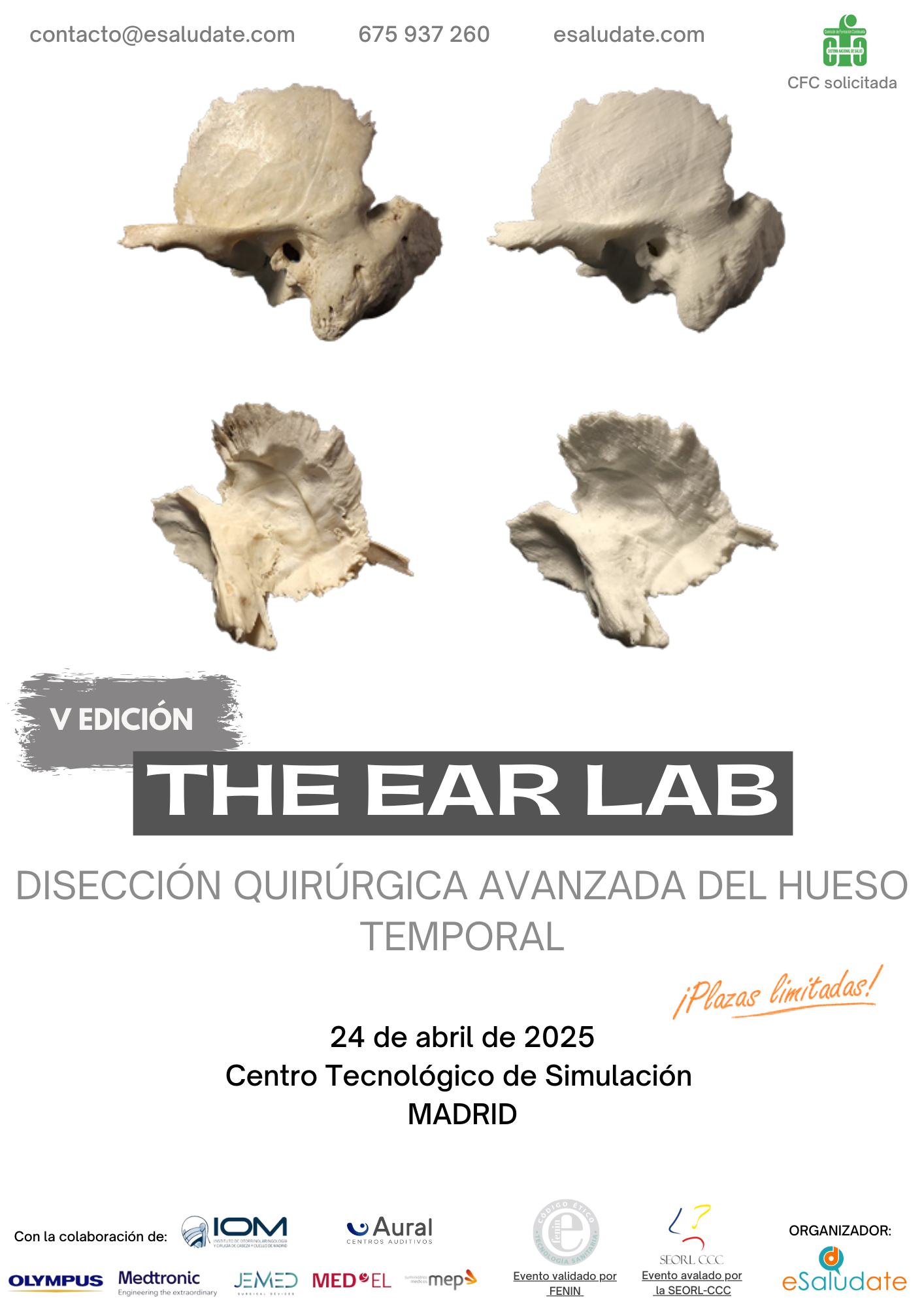 The Ear Lab   Hueso Temporal   24 De Abril De 2025(1)