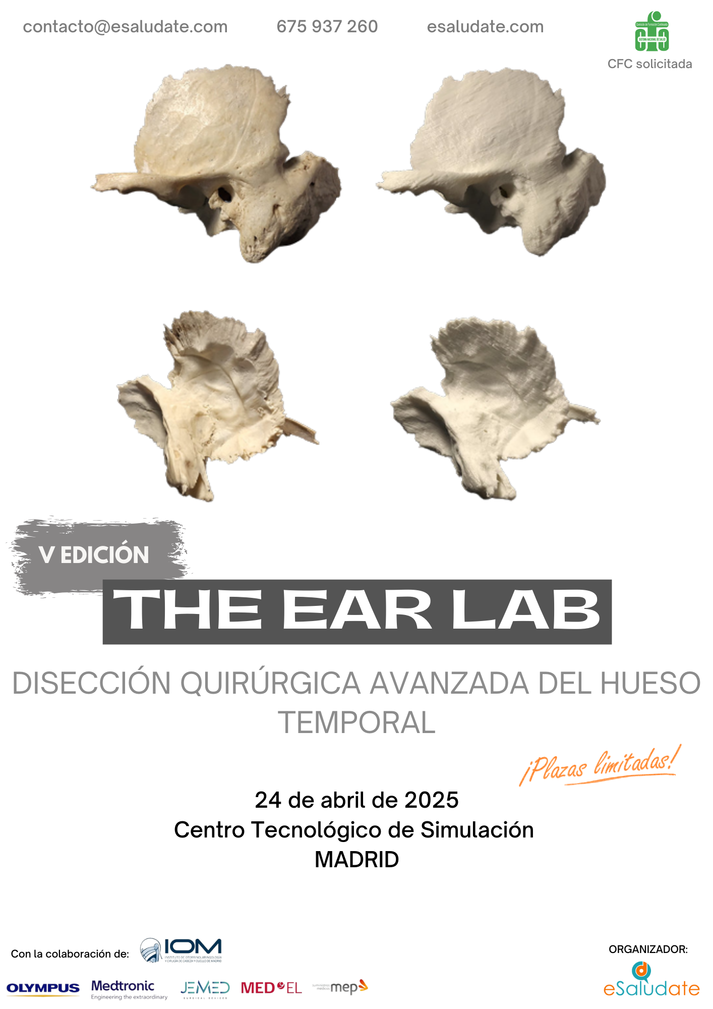 The Ear Lab   Hueso Temporal   24 De Abril De 2025